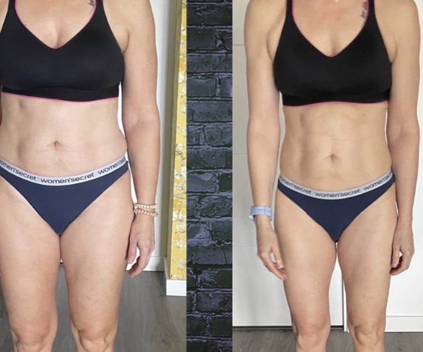 Antes y después de un cliente de Hermetic Way